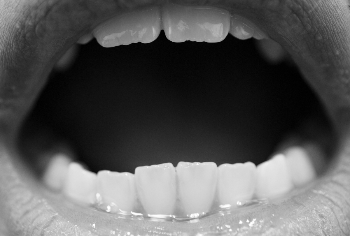 A black and white photograph shows teeth in an open mouth.